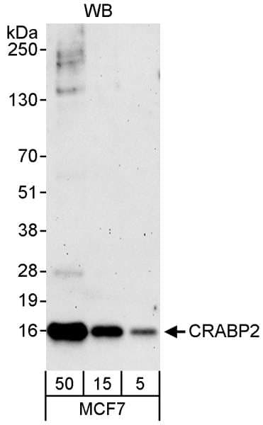 Polyclonal Rabbit anti-Human CRABP2 Antibody (aa80-C-term, IHC, WB)