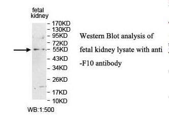 F10 / Factor X Antibody (aa314-485)