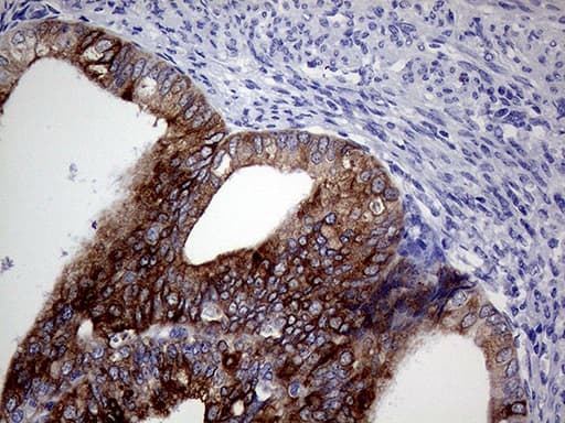 AGR2 Antibody (aa21-175, clone OTI1H8)