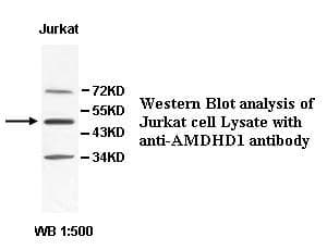 IHC-plus™ AMDHD1 Antibody (aa152-414)