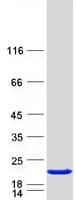 Human VILIP / VSNL1 Protein (Recombinant Myc-DDK (Flag))