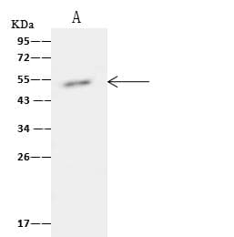 TIPIN Antibody