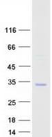 Human HLA-DQB2 Protein (Recombinant Myc-DDK (Flag))