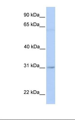 MARCH2 Antibody (aa146-195)