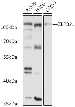 Polyclonal Rabbit anti-Human ZNF295 Antibody (WB)