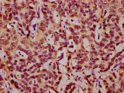Polyclonal Rabbit anti-Human HIST1H2AI Antibody (IHC, WB)