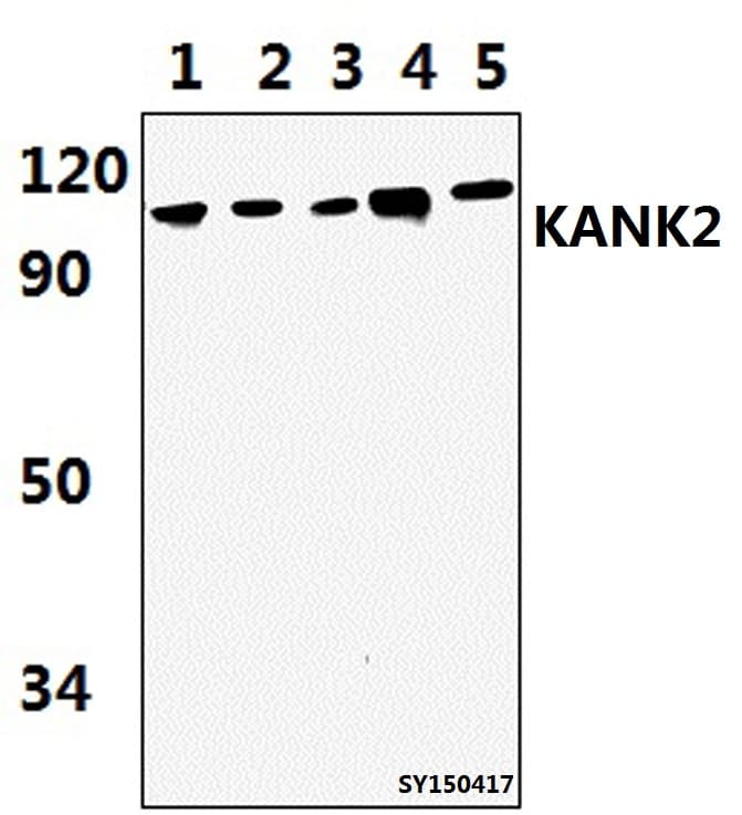 Polyclonal Rabbit anti-Human KANK2 Antibody (IHC, WB)