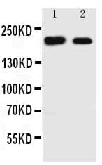 Tuberin / TSC2 Antibody (aa1605-1620)