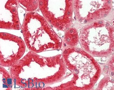 IHC-plus™ Polyclonal Goat anti-Human TTR / Transthyretin Antibody (IHC, WB)