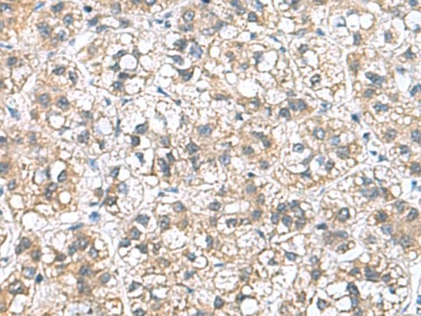 Polyclonal Rabbit anti-Human NFKB1 / NF-Kappa-B Antibody (IHC)