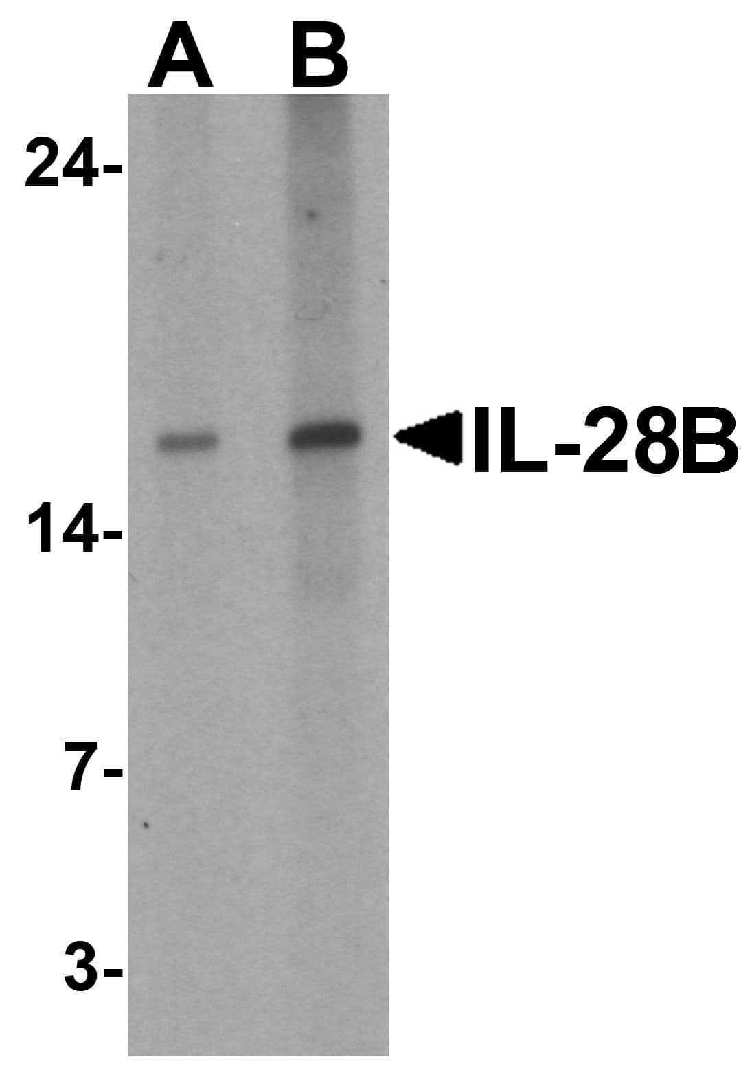 IL28B Antibody