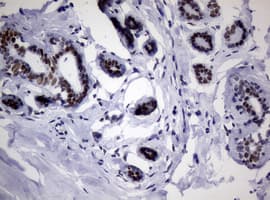 NBN / Nibrin Antibody (clone OTI7D5)