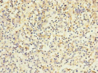 HVCN1 / HV1 Antibody