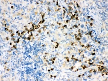 Polyclonal Rabbit anti-Human ACTA1 / Skeletal Muscle Actin Antibody (IHC, WB)