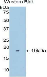 POSTN / Periostin Antibody (aa500-630, APC)