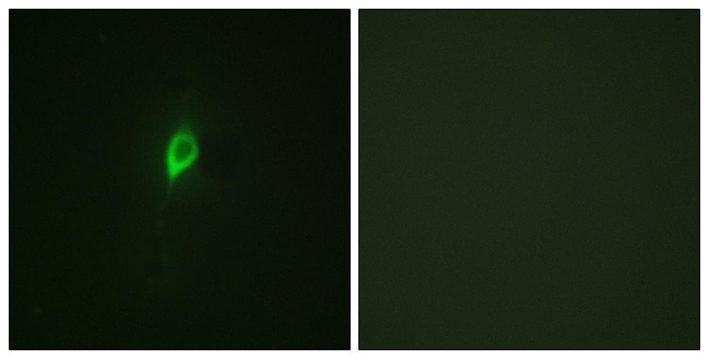 EIF4B Antibody (phospho-Ser422)