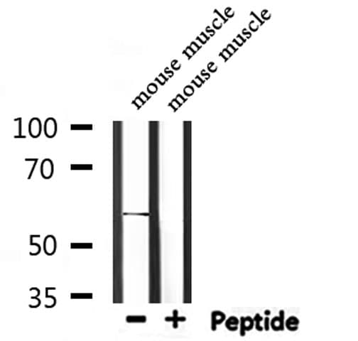 ALK3 / BMPR1A Antibody