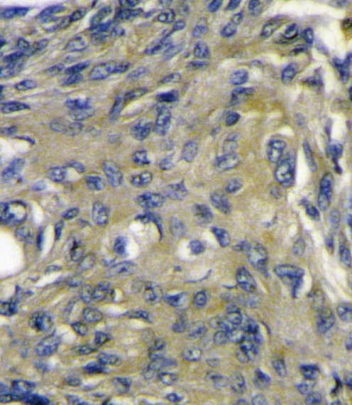 VEGFD Antibody (aa322-352)