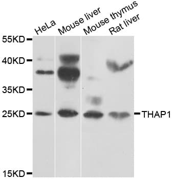 THAP1 Antibody (AP)