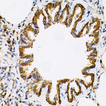 HSP90AB1 / HSP90 Alpha B1 Antibody