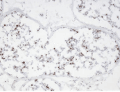 DUX4 Antibody (clone P2B1)