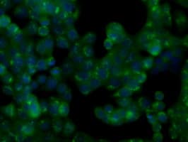 Monoclonal Mouse anti-Human NIT2 Antibody (clone OTI5A3, IHC, IF, WB)