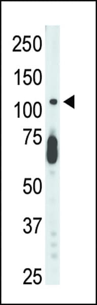 Polyclonal Rabbit anti-Human STK9 / CDKL5 Antibody (aa982-1012, IHC, WB)