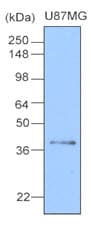 IHC-plus™ CLU / Clusterin Antibody (aa1-333, clone 1A11)
