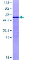 Human ZNRF1 Protein (Recombinant GST)