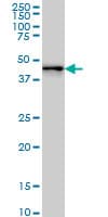 ZNF191 / ZNF24 Antibody (clone 4A1)