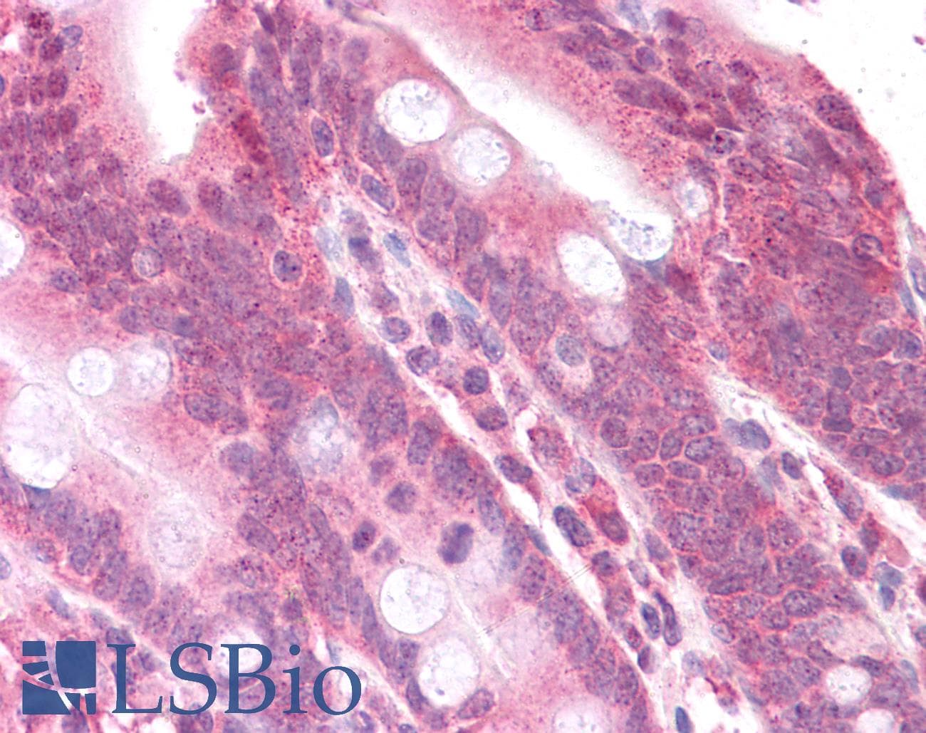 Polyclonal Rabbit anti-Human MAP2K2 / MKK2 / MEK2 Antibody (N-Terminus, IHC, WB)