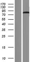 DDX33 / DHX33 Protein (Over-Expression Lysate Myc-DDK (Flag))
