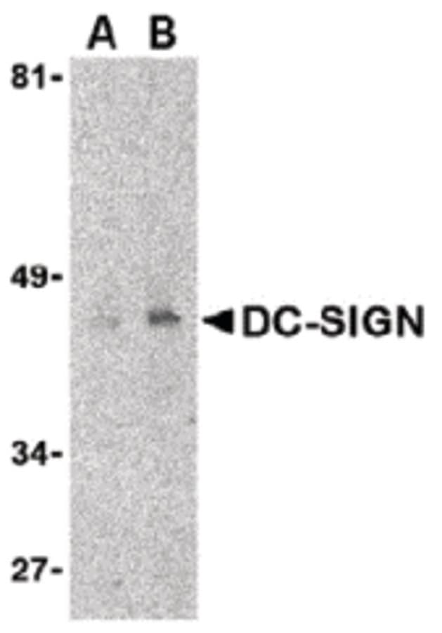 IHC-plus™ CD209 / DC-SIGN Antibody (clone 8B6)