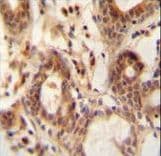 NUDT15 Antibody (aa89-118)