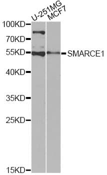 SMARCE1 / BAF57 Antibody