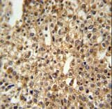 DENND1A Antibody (aa576-605)