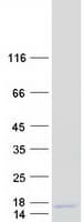 Human LYRM2 Protein (Recombinant Myc-DDK (Flag))