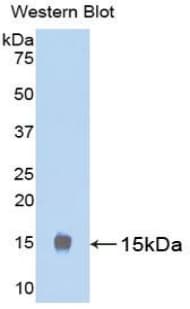 LHB / Luteinizing Hormone Antibody (aa21-141)