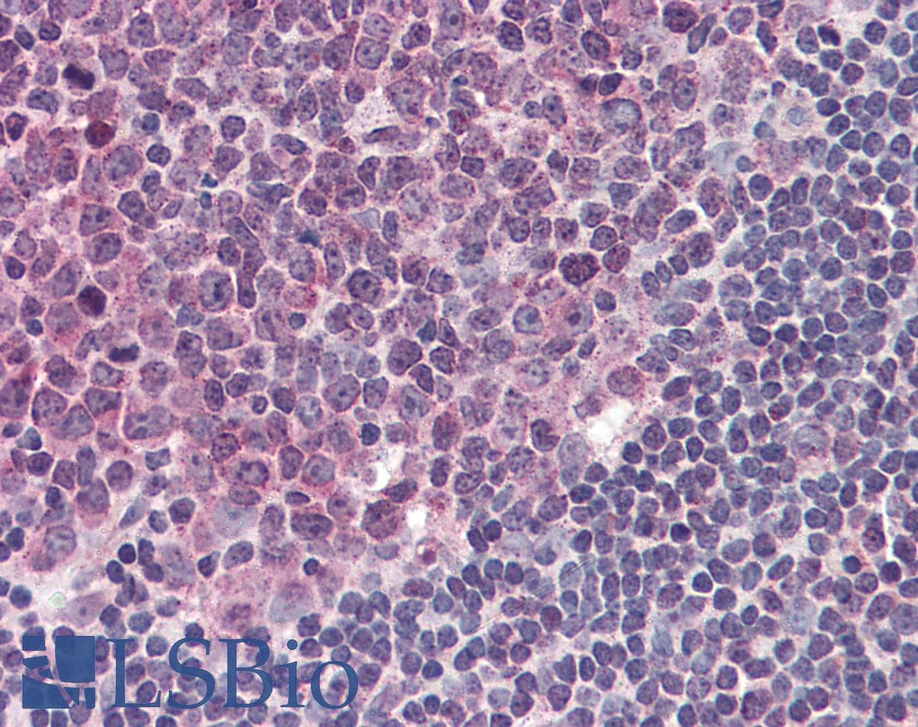 IHC-plus™ TLR4 Antibody (clone 1E11)