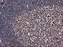 TRIM38 Antibody (clone OTI113D3)