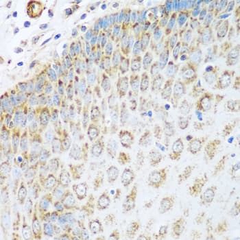 Polyclonal Rabbit anti-Human GLUD1/Glutamate Dehydrogenase Antibody (IHC, WB)