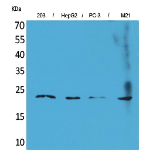 FGF6 Antibody (C-terminal)
