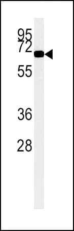 IHC-plus™ ACOX1 / ACOX Antibody
