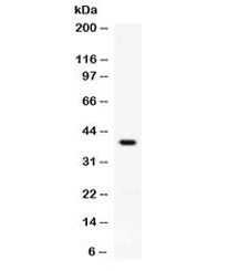 TNFSF11 / RANKL / TRANCE Antibody