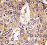 CSNK1G2 / CKI-Gamma 2 Antibody (aa329-360)