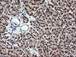 MAP2K2 / MKK2 / MEK2 Antibody (clone OTI1A2)