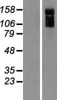 ARHGAP31 / CDGAP Protein (Over-Expression Lysate Myc-DDK (Flag))