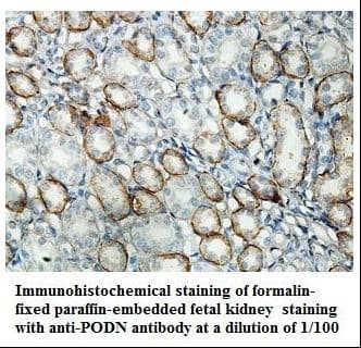Polyclonal Rabbit anti-Human PODN Antibody (aa69-236, IHC, WB)