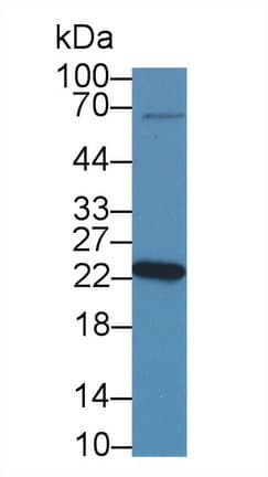 NME5 Antibody (aa3-194)