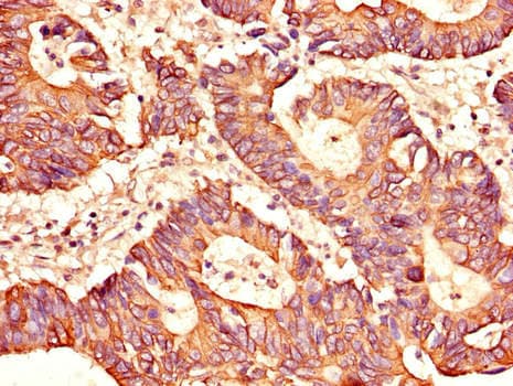 Polyclonal Rabbit anti-Human EAT2 / SH2D1B Antibody (IHC, IF)